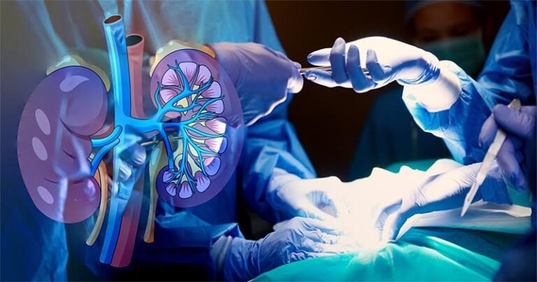Falta de doadores dificulta transplantes de rim e prejudica o tratamento da Doença Renal Crônica no Brasil