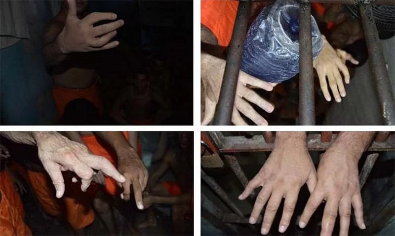 Técnica de tortura de fraturar dedos de presos é usada em cinco estados